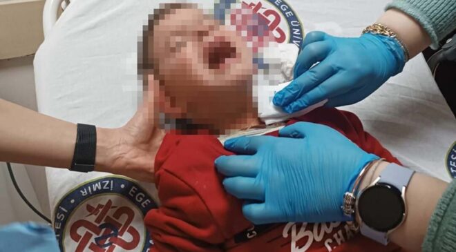 Parkta Bıçaklı Salgın: 2 Yaşındaki Çocuk Yaralı!