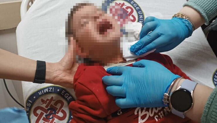 Parkta Bıçaklı Salgın: 2 Yaşındaki Çocuk Yaralı!